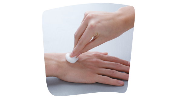 Persona limpia una quemadura en la mano con una gasa Cutisoft®. Persona limpia una quemadura en la mano con una gasa Cutisoft®.